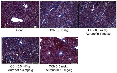 Masson’s Trichrome staining