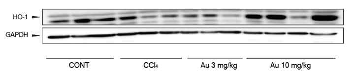 HO-1의 발현