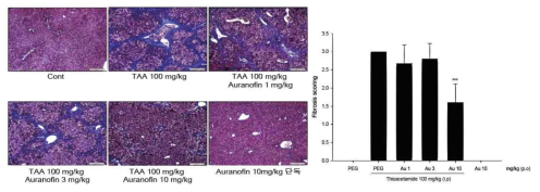 Masson’s Trichrome staining과 fibrosis score