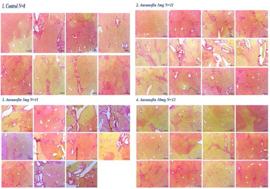 Sirius red staining