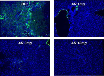 Bile duct ligation model에서 간 내 섬유화 마커인 α-SMA 감소