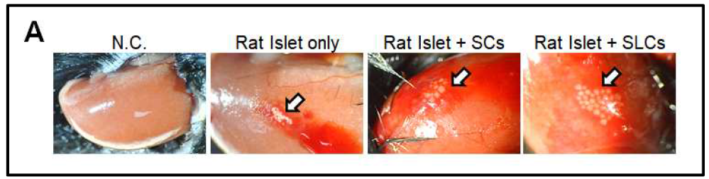 당뇨모델 생쥐의 신피막 이식과 이식된 당뇨모델 생쥐의 혈당 측정 확인(계속)