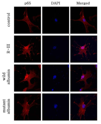 R-III treatment and albumin expression promote nuclear translocation of NF-kB