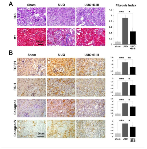 R-III reduces UUO-induced renal fibrosis