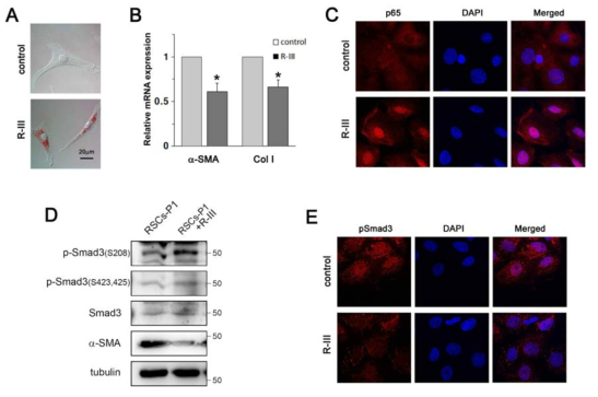 The anti-fibrotic effect of R-III on RSCs in vitro