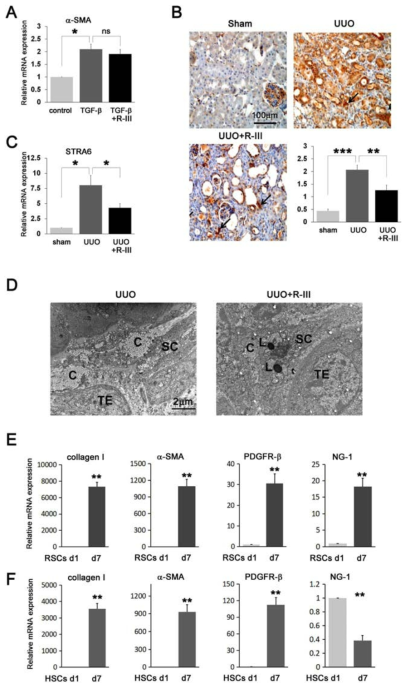 The anti-fibrotic effect of R-III on RSCs in vitro