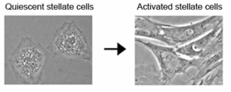 성상세포의 활성화과정에서 관찰되는 세포형태의 변화