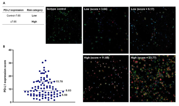 (A) PD-L1 발현 점수에 따른 면역형광염색 이미지. PD-L1 발현에 대한 MFI 측정값이 7.6 미만인 경우 저위험군, 7.6 이상인 경우 고위험군인 것으로 분류함. (B) 다발골수종 환자에서 PD-L1 발현의 분포