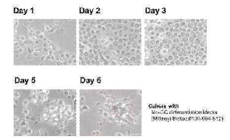 CD14+ 세포를 이용한 DC 분화시 배양일자별 세포 morphology를 현미경으로 확인함(x400)