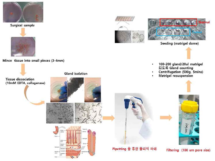 Patient-derived organoids (PDO) 제작 과정