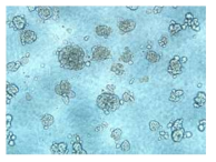 gastric cancer cell-line으로부터 만들어진 spheroids (Bright field, x40)