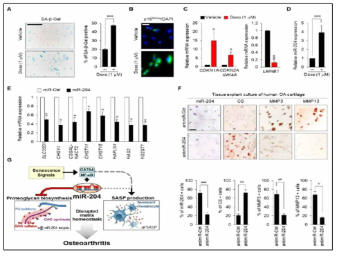 퇴행성슬관절염 환자 연골세포 배양을 통한 miR-204의 기능 규명 사례