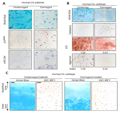 OA환자의 연골조직에서 miR-204(A), TNKS(B), IRF1(C) 관찰
