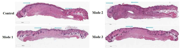 D14, 상처치유 부위의 조직학적 변화