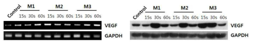 조직 내 혈관생성 성장인자 발현확인