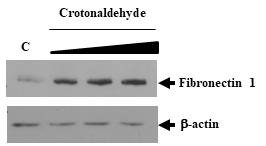 신장 세포에서 독성물질 처리에 의한 Fibronectin 1의 발현 변화