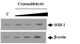 신장 세포에서 독성물질 처리에 의한 SOD-1의 발현 변화