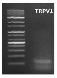 통증 담당 수용체 TRPV1 발현 확인