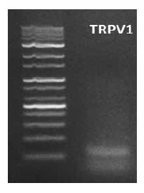 통증 담 당수용체 TRPV1 발현 확인