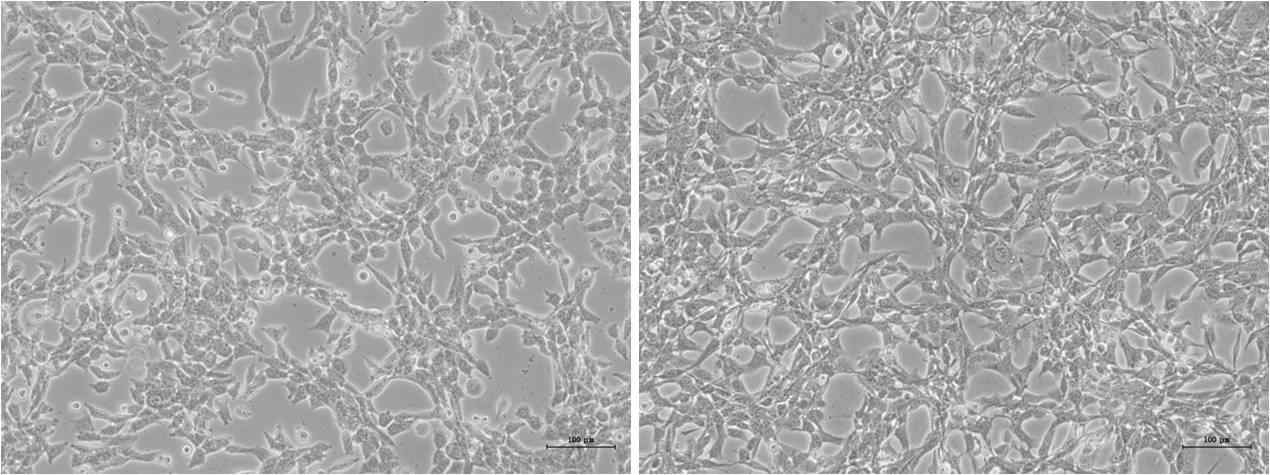 LLC1 세포(좌)와 CT26.WT 세포(우)의 배양액 확보 직전 사진