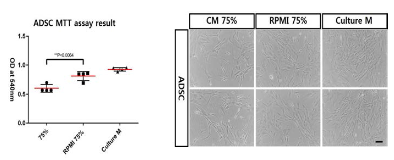 MTT assay를 이용하여 지방 유래 줄기세포의 분열능