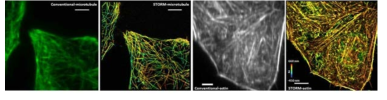 기존 광학계와 STORM에서의 마이크로튜블과 액틴의 이미지 비교