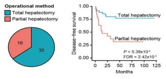 간암환자의 수술 방법에 따른 간암 재발 위험성 비교
