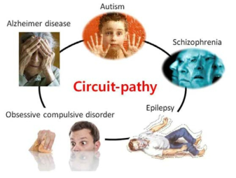 Circuitopathy 가설: 신경회로 기능저하에 의해서 다양한 뇌질환이 발병될 수 있음