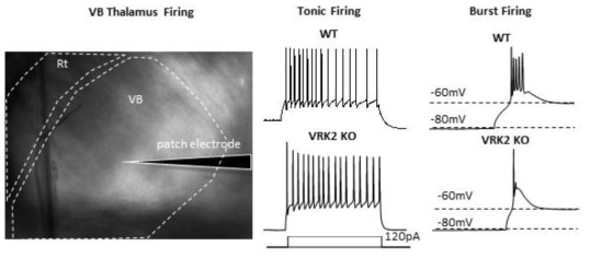 VRK2 KO 마우스 시상 전달핵 신경세포 발화패턴 분석