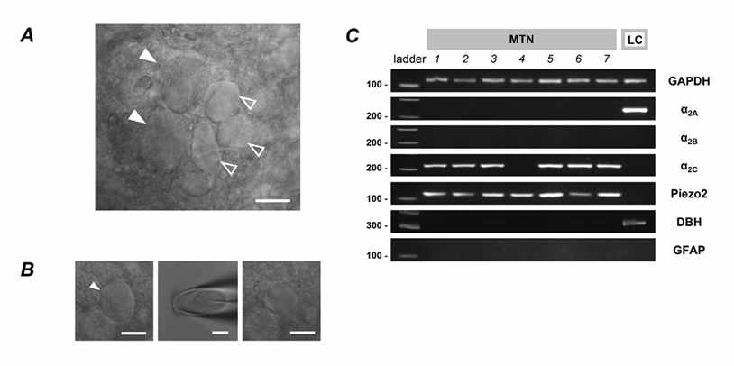 MTN 뉴런의 NA 수용체 mRNA 확인 단일 MTN 신경세포에서 alpha 2A, 2B AR mRNA는 검출되지 않았음. alpha 2C AR mRNA는 모든 세포에서 검출됨