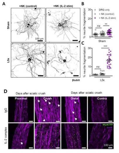 활성화된 NK 세포가 손상된 신경을 파괴시키는 것을 발견하였음. (A-C) NK 세포-DRG 뉴런의 공동배양을 통하여 IL-2에 의해 활성화된 NK 세포가 신경 손상 모델의 DRG 뉴런 L5 axon을 파괴시켰음. (D) Siatic nerve crush 모델에서 IL-2에 의해 활성화된 NK 세포가 crush region으로 NK 세포가 침윤되는 것을 관찰하였음