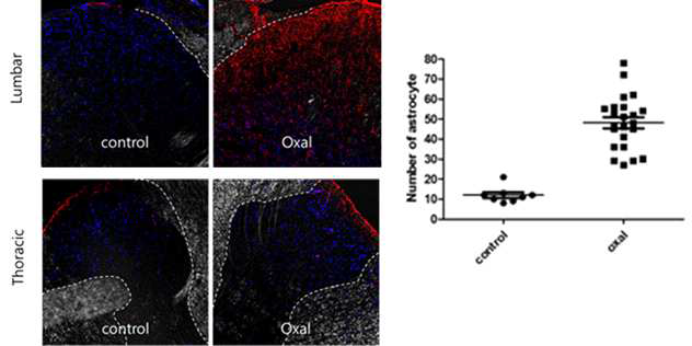 oxaliplatin으로 유도한 만성통증 모델에서 성상교세포의 활성화를 학인 Oxaliplatin을 투여 받은 쥐에서는 lumbar level의 dorsal horn에서 성상교세포의 수가 두드러지게 증가하는 것을 확인함. 이러한 성상교세포의 변화가 말초신경의 손상 정도에 의해 일어나는 것 임을 확인하기 위하여 비교적 말초신경이 짧아 손상이 적다고 알려진 thoracic level의 성상교세포를 관찰하였고, 대조군에 비해서 oxaliplatin을 투여 받은 쥐의 dorsal horn에서 성상교세포의 활성이 증가하지 않은 것을 확인하였음
