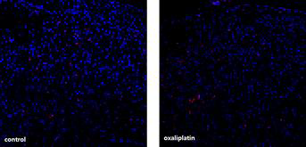 oxaliplatin으로 유도한 만성통증 모델에서 미세교세포의 활성화를 학인 대조군에 비해 oxaliplatin을 투여받은 쥐에서는 lumbar level의 dorsal horn에서 미세교세포의 수가 증가하지 않는 것을 확인하였음