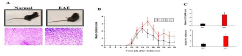 유발 동물모델 구축 및 CRBN삭제에 따른 EAE 증상 악화 확인. A) EAE 유발 확인. B) Clinical disease score분석을 통해 CRBN삭제에 의한 EAE병증 악화 확인. C) CRBN삭제에 따른 EAE병증과 관련된 시토카인 발현 증가를 qPCR을 통해 확인