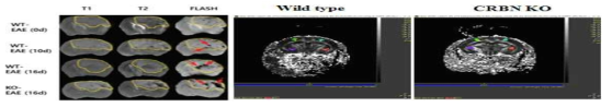 MRI촬영을 통한 EAE유발 마우스의 CRBN발현에 따른 병증 차이