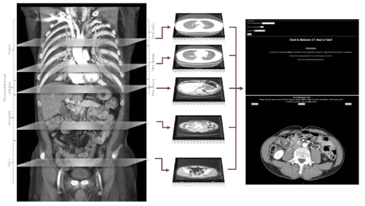 PGGAN을 이용한 CT 생성 및 평가 과정