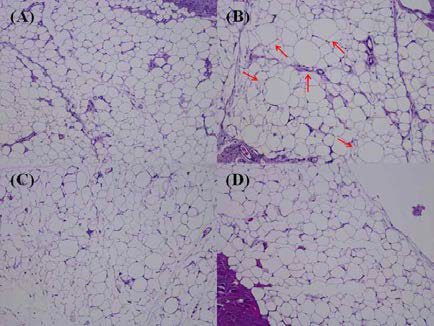 부고환 지방조직 (A) Normal, (B) HFD, (C) HFD-OJD, (D) HFD-OJH