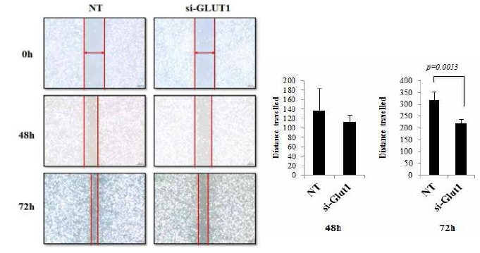 GLUT1을 억제시켰을 때 MDA-MB231 유방암 세포주의 이동이 감소한 것으로 확인하였음. 48시간 이후에는 감소는 하였지만, 통계학적 유의성은 확인하지 못함. 그러나, 72시 간 후에는 통계학적으로도 유의하게 이동이 감소한 것 확인