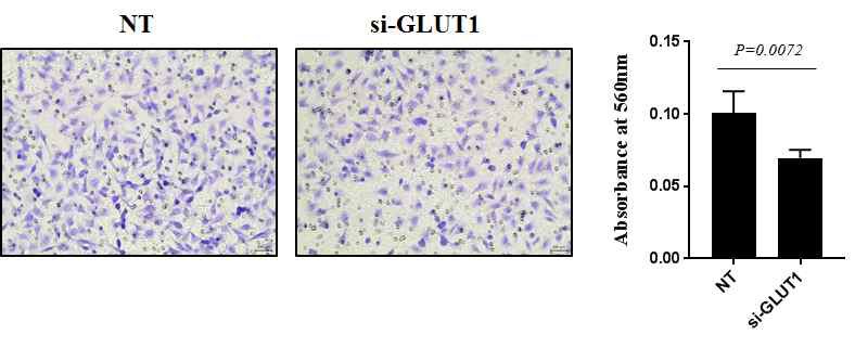GLUT1을 억제시켰을 때 MDA-MB231 유방암 세포주의 침윤도 역시 감소한 것으로 확인 하였음. 통계학적인 유의성 역시 확인됨 (p=0.0072)