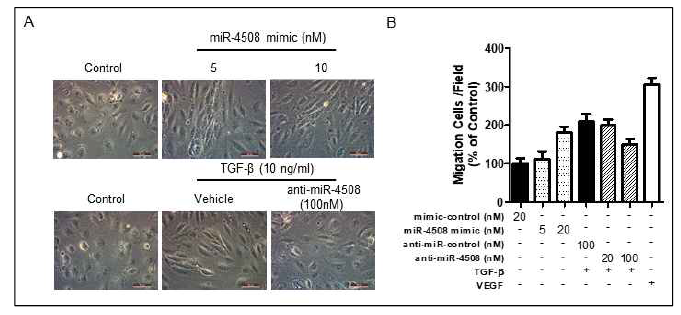 miR-4508 발현변화에 따른 세포모양 변화 (A) 및 세포이동활성 확인 (B)