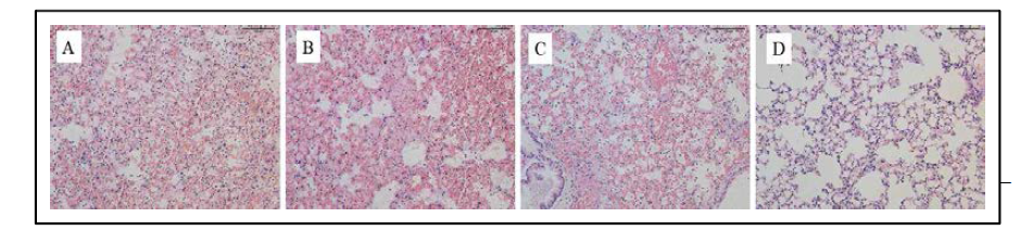 L. pneumophila 감염 후 마우스 폐조직의 병리조직학적 소견의 비교 분석 (H B, CpG-ODN 면역; C, Peptide #8 면역; D, CpG-ODN/Peptide #8 면역