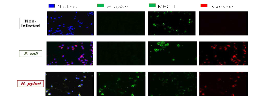형광현미경을 통한 H. pylori 감염 수지상 세포의 MHC II 발현 및 lysozyme 활성 분석