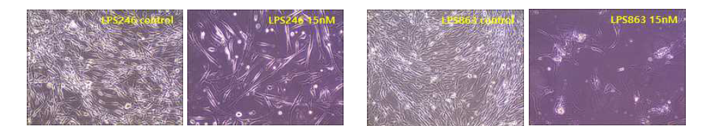 LPS cell lines을 이용한 LBH589(HDAC inhibitor)를 15nM 농도 처리시의 cell의 형태변화