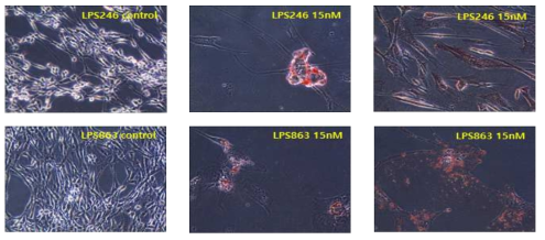 LPS cell lines을 이용한 LBH589(HDAC inhibitor)를 15nM 농도 처리시 Oil Red O 염색