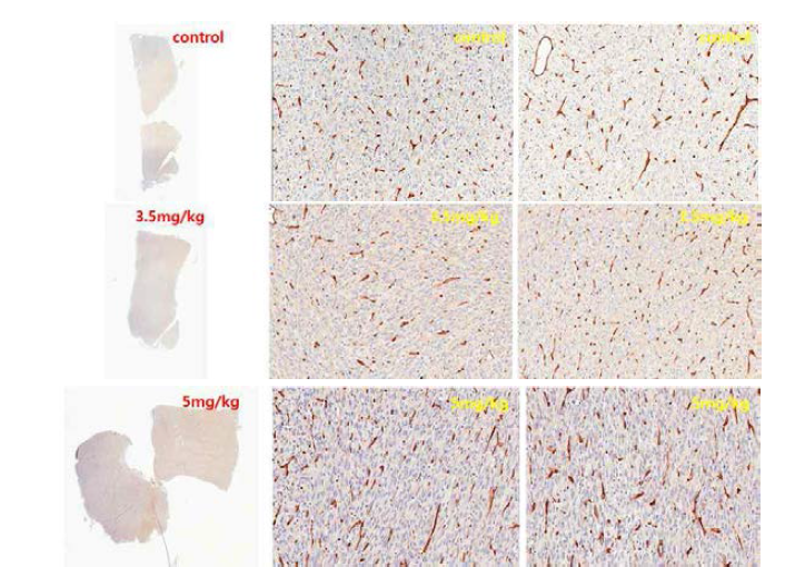 Immunohistochemical analysis of LPS246 xenograft tissue for FABP4