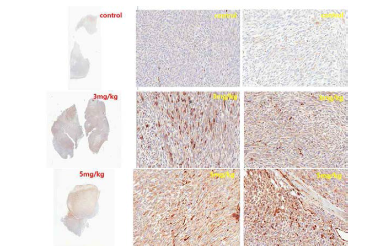 Immunohistochemical analysis of LPS863 xenograft tissue for FABP4