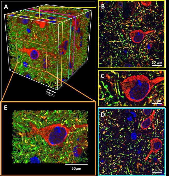 팽창현미경을 이용한 쥐 뇌 절편 내부의 신경세포 삼차원 이미징. (A) 106 um3 부피를 60 nm 해상도로 관찰한 결과. TH(빨간색), 핵(파란색), MAP2(녹색). (B-D) (A)의 세 가지 z-plane을 확대한 그림. (E) (A)의 이미지의 일부분을 삼차원으로 나타낸 결과