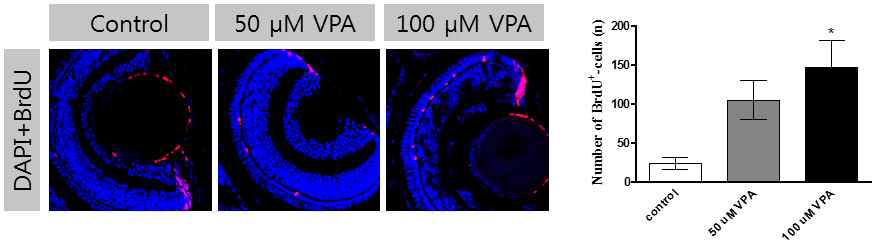 수정 후 1일에 50 또는 100 μM VPA에 처리되어 수정 후 5일이 된 유어의 망막에서 관찰된 BrdU 표지 세포의 변화