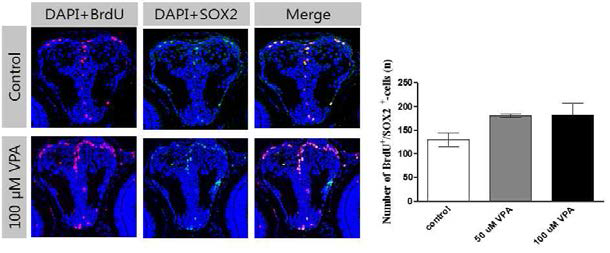 수정 후 1일에 VPA에 처리되어 수정 후 5일이 된 유어의 전뇌에서 BrdU와 SOX2 표지 세포의 분포와 수