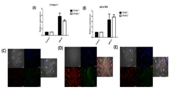 Exogenous TGFb1 (0.5 μg/ml) 을 넣고 24시간 키운 세포에서 negative control 에 비해 높은 collagen I 과 α-SMA (myofibroblast 의 marker) mRNA expression 이 현저히 증가하는 것을 확인하였다 (A,B). 또한 세포면역염색 (ICC) 에서 Exogenous TGFb1 이 들어간 세포는 (D) negative control (C) 과 비교해 세포의 모양이 변하고 α-SMA 염색이 (green) 되어 fibroblast to myofibroblast trans-differentiation 이 되었음을 확인하였다. 또한 CCN5+TGF-b1 group 의 경우 (c) CCN5에 의해 세포 모양이 다시 control과 비슷한 형태와 비슷함을 보였다